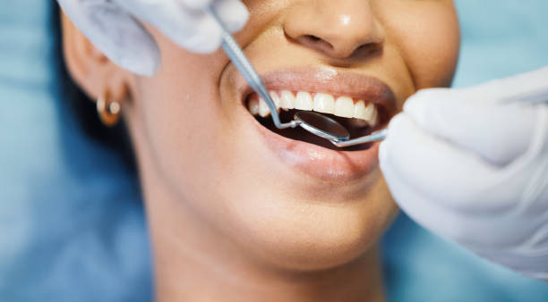 Best Emergency Gum Treatment in Paterson, NJ